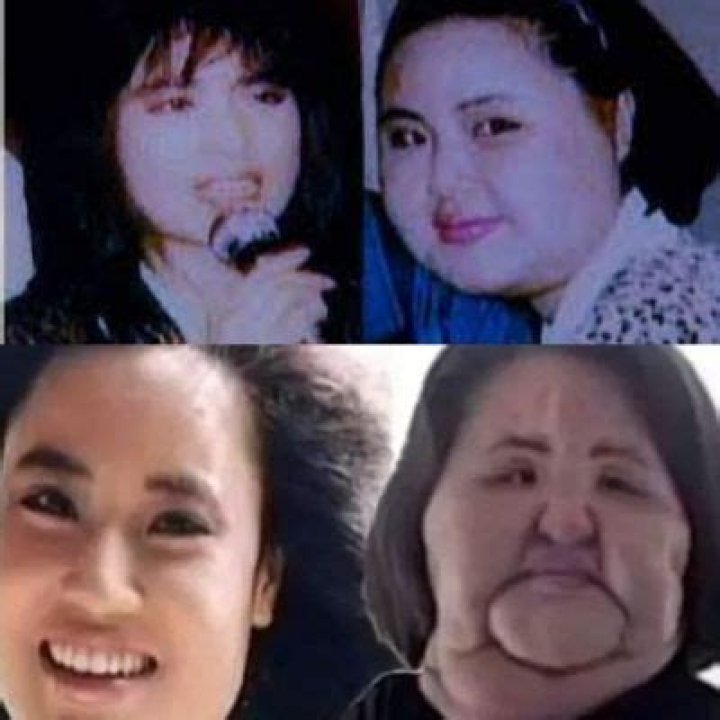 What Became Of Hang Mioku After He Underwent Endless Plastic Surgery? Know What She Is Doing Right Now